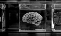 Hjerne i Klorofom